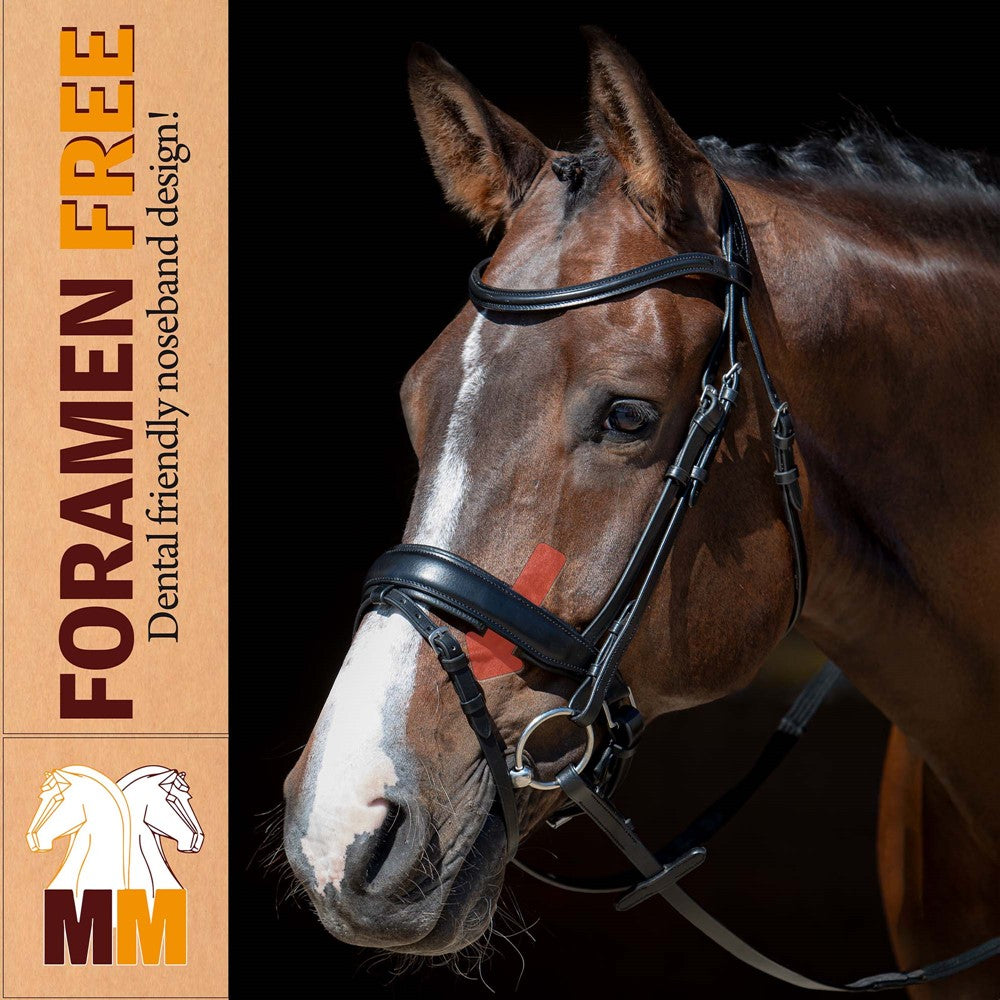 Tan Trense MM Foramen Free